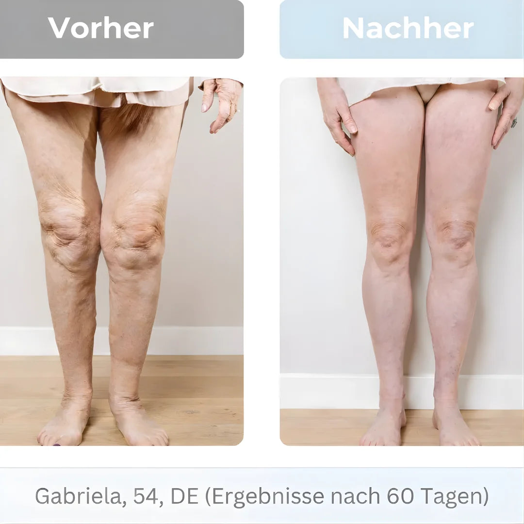 RESTIVA™ EMS-TECHNOLOGIE FÜR LEICHTE BEINE IM ALLTAG