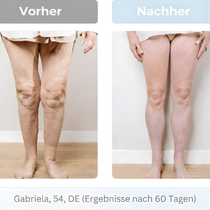 RESTIVA™ EMS-TECHNOLOGIE FÜR LEICHTE BEINE IM ALLTAG